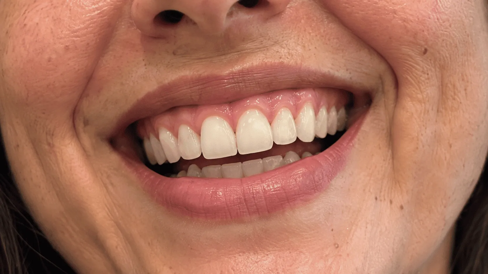 Primer plano de una sonrisa con encías sanas